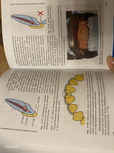 Raamat Hambaproteesimise tehnoloogia põhialused 2016 (foto #9)