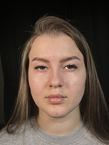 Kulmude värvimine/korrigeerimine/lamineerimine (2 foto / 8)