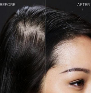 Մազերի խտացուցիչ Toppik hair fiber (7 լուսանկար / 9)