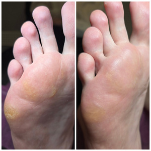 Maniküür,pediküür, geellakk,gel, IBX system Lasnamäe (8 foto / 10)