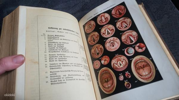 Saksakeelne tervise raamat 1890.a (foto #7)