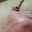 Henri Bendeli sõrmus (foto #2)