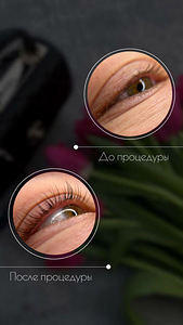 Ламинирование ресниц (3 фото из 5)
