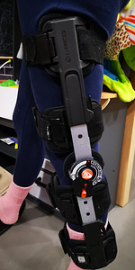 Коленный ортез breg (3 фото из 3)