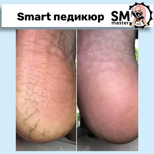Nutikas pediküür geellakiga (4 foto / 10)
